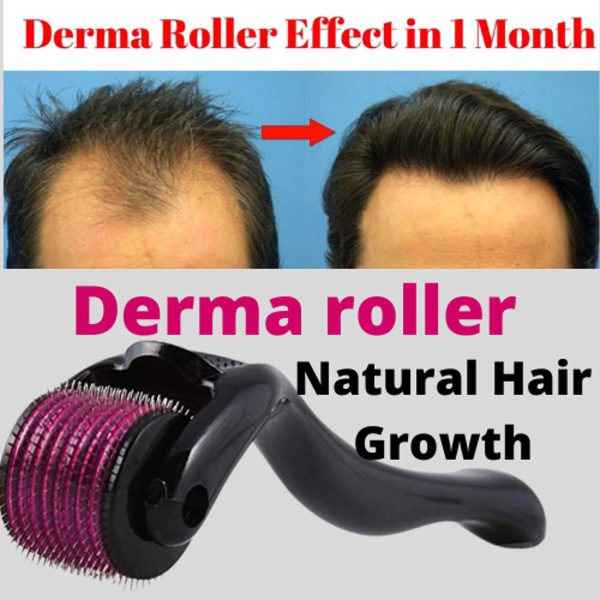 Derma Roller For Hair Re-growth & Skin